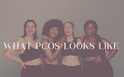 PCOS Series Part 1: What PCOS Looks Like
