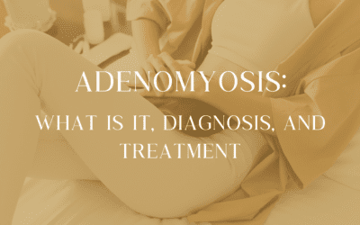 Adenomyosis: What is it, Diagnosis, and Treatment